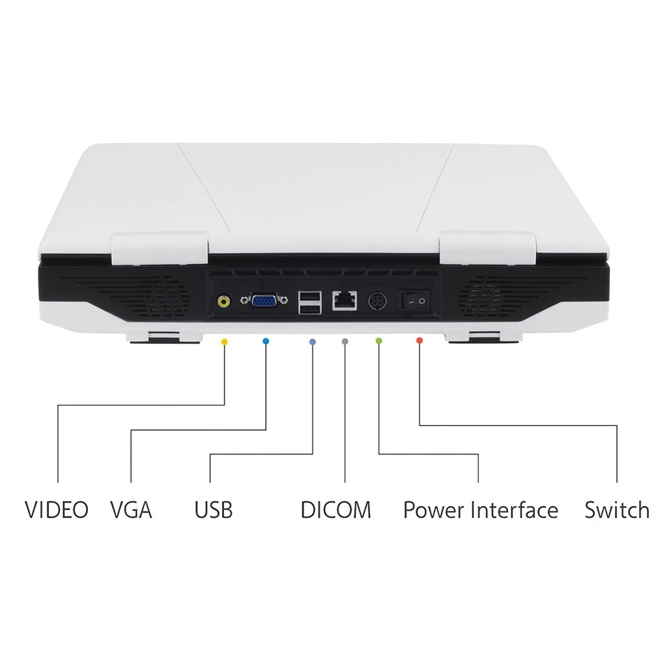Laptop Ultrasound Machine best