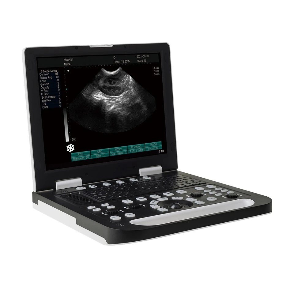 Laptop Ultrasound Machine factory